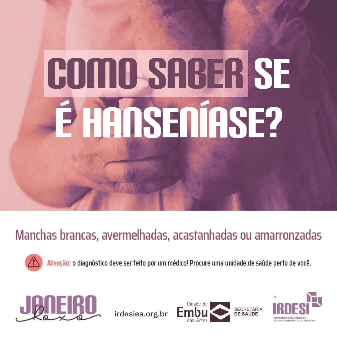 A Importância do Diagnóstico Precoce da Hanseníase: Transformando Vidas e Controlando a Doença